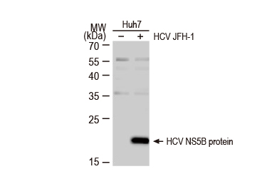 Hepatitis C Virus NS5B protein antibody