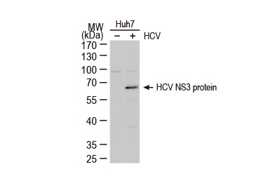 Hepatitis C Virus NS3 protein antibody