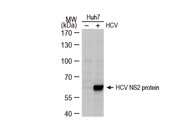 Hepatitis C virus NS2 protein antibody