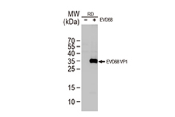Enterovirus D68 VP1 antibody