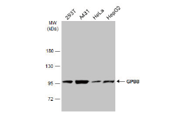 GPBB antibody GPBB antibody
(GTX104291)