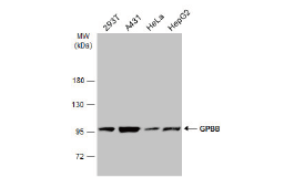 GPBB antibody
(GTX104291)