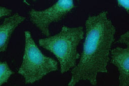 PGM1 antibody
(GTX110069)
