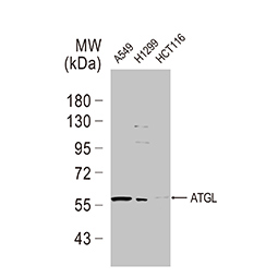 ATGL antibody [N1C1]
