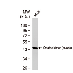 Creatine kinase (muscle) antibody [N1C3]