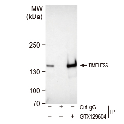 Timeless antibody (GTX129604)