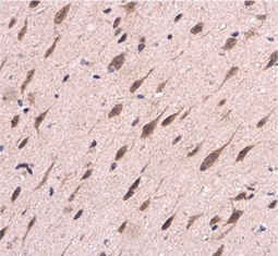 Tau antibody