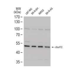 C9orf72 antibody (GTX632041)