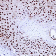 TDP43 antibody