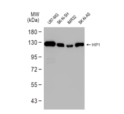 HIP1 antibody (GTX131449)