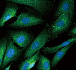 Huntingtin antibody (GTX132433)