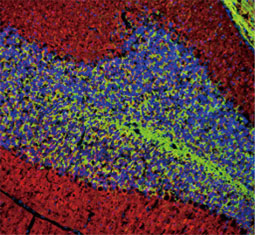 PGP9.5 antibody (GTX109637)