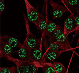 SOD1 antibody (GTX100554)