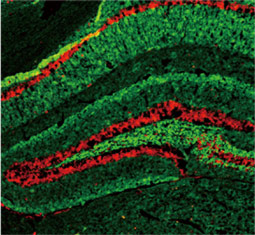alpha Synuclein antibody