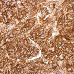 CD10 antibody [N2C1], Internal (GTX111680)
