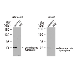 Dopamine beta hydroxylase antibody GTX101616