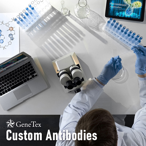 Custom Antibodies