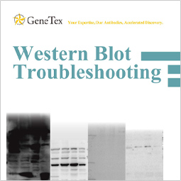 Western Blot Troubleshooting
