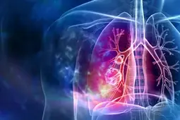 Article Alert: The CXCL14/ACKR2 Axis Drives Lung Cancer Metastasis