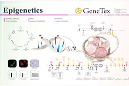 Epigenetics poster