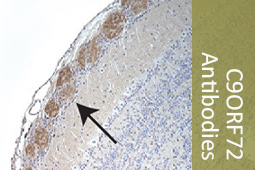 Independent Knockout Validation of C9ORF72 Antibodies