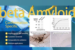 beta Amyloid