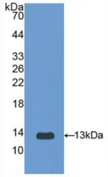 Rat IL1 Receptor 1 protein, His tag. GTX00051-pro