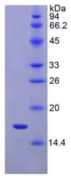 Rat IL1 Receptor 1 protein, His tag. GTX00052-pro