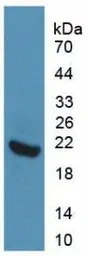Rat IL1 Receptor 1 protein, His tag. GTX00053-pro