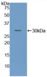 Rat Coagulation factor III/Tissue Factor protein, His tag. GTX00054-pro