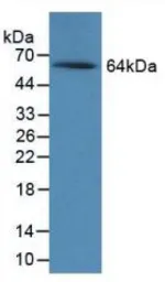 Rat Noggin protein, His and MBP tag. GTX00055-pro