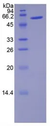 Rat Noggin protein, His and MBP tag. GTX00055-pro