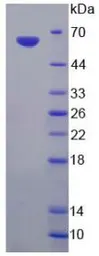Rat EndoG protein, His and GST tag. GTX00057-pro