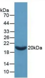 Rat Coagulation Factor II protein, His tag. GTX00058-pro