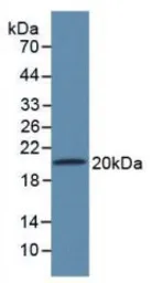Rat SLIT2 protein, His tag. GTX00062-pro