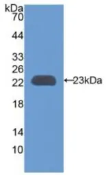 Rat TIMP3 protein, His tag. GTX00064-pro