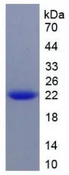 Rat TIMP3 protein, His tag. GTX00064-pro