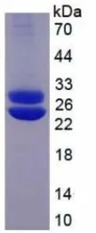 Human Prolactin protein, His tag (active). GTX00069-pro