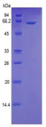Human Fas protein, His and MBP tag. GTX00080-pro
