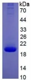 Human IL10 protein, His tag (active). GTX00086-pro