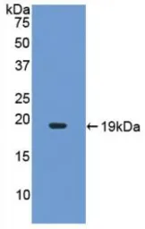 Human IL17A protein, His tag. GTX00090-pro