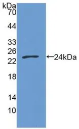 Human GAS6 protein, His tag (active). GTX00106-pro