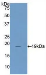 Human IL1 Receptor antagonist protein, His tag. GTX00108-pro