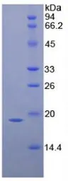 Human IL1 Receptor antagonist protein, His tag. GTX00108-pro