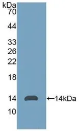 Human AMH protein, His tag. GTX00109-pro
