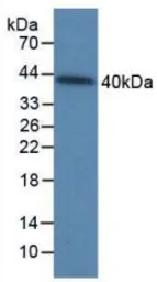 Human Galectin 9 protein, His tag. GTX00111-pro