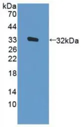 Human PKR protein, His tag. GTX00113-pro