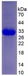 Human PKR protein, His tag. GTX00113-pro