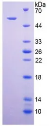 Human DR5 protein, His and GST tag. GTX00121-pro