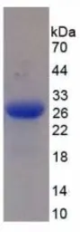Human MASP2 protein, His tag. GTX00122-pro